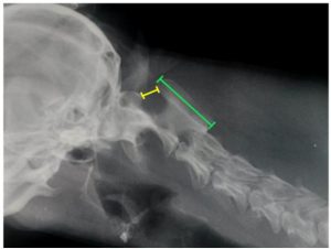 Subluxação Atlantoaxial em Cães: Um Desafio Neurológico